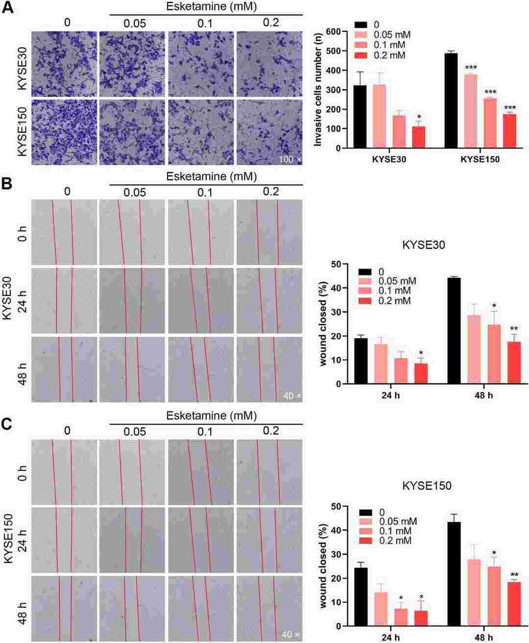 Esketamine treatment reduced the migration and invasion capabilities of esophageal squamous carcinoma cells.