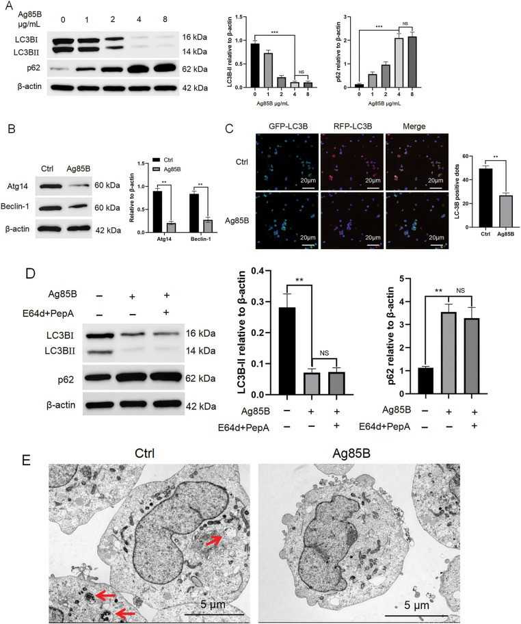 Ag85B inhibits autophagy in human Hodgkin lymphoma cells.