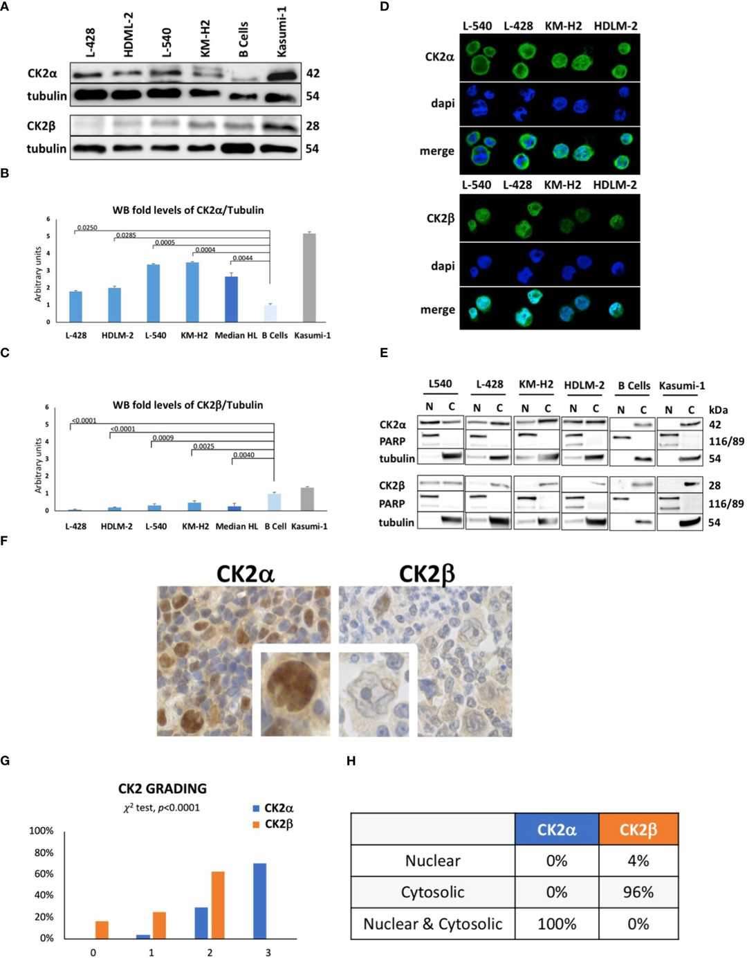 CK2 subunits are unbalanced in HL cell lines.