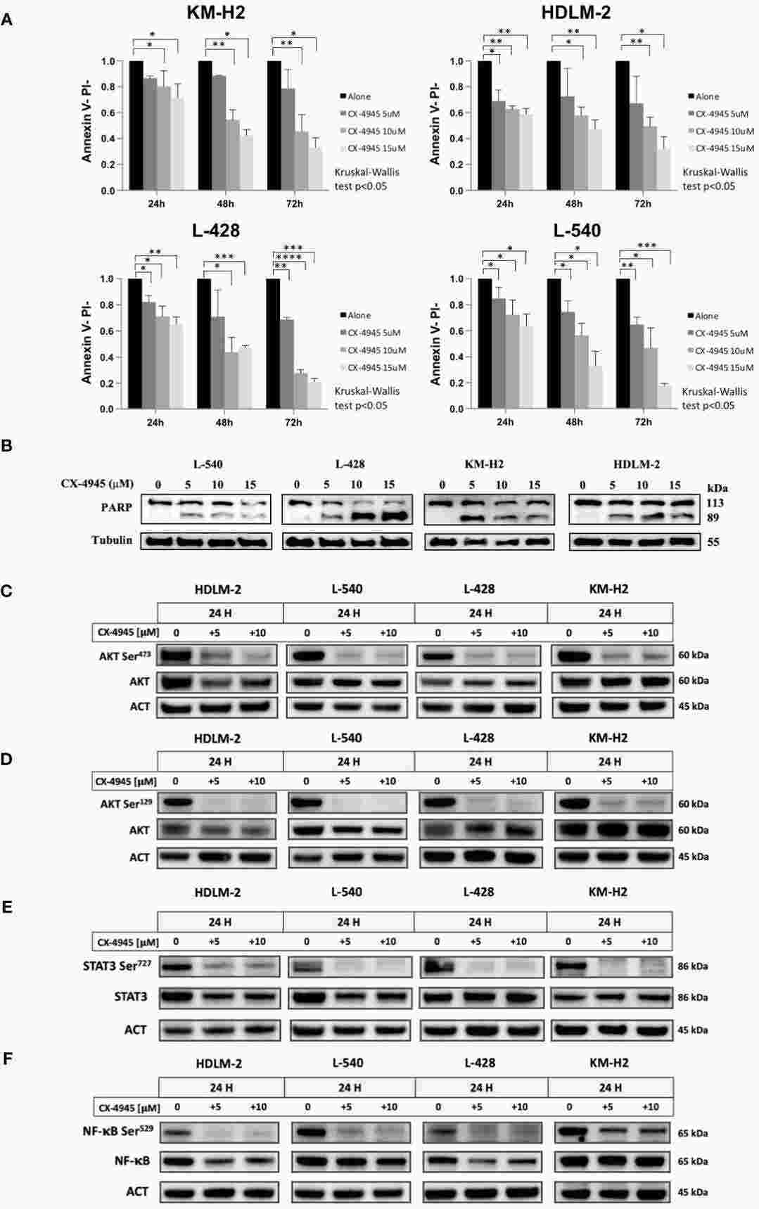 CK2 inhibition triggers HL apoptosis.