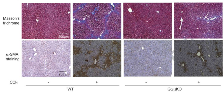 Liver fibrosis is inhibited by Gα12KO. Masson’s trichrome staining and α-SMA staining of liver tissue of different treatment group.