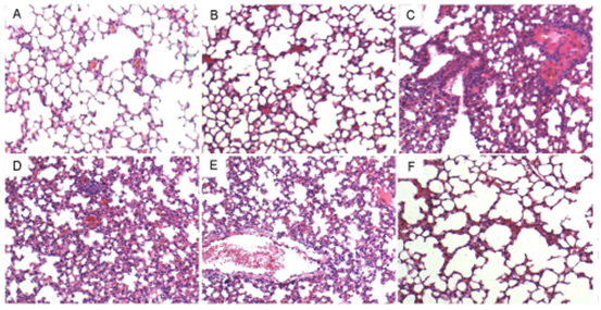 Effects of alliin on histopathological changes in lung tissues in LPS-induced ALI mice. Representative histological changes of lung obtained from mice of different groups. A: Control group, B: alliin (100 mg/kg) alone group, C: LPS group, D: LPS+ alliin (25 mg/kg) group, E: LPS + alliin (50 mg/kg) group F: LPS + alliin (100 mg/kg) group (Hematoxylin and eosin staining, magnification 200×).
