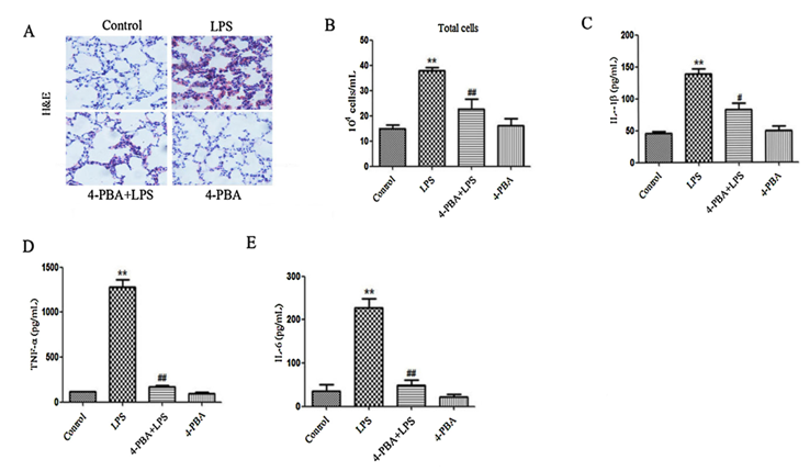 Effect of 4-PBA on structural damage and production of inflammatory mediators induced by LPS in mice. (A) Lung sections of the mice were stained with representative H&E for histological examination (magnification × 200). (B) BAL fluid was performed to differentially count total cells. IL-1b (C), TNF-a (D) and IL-6 (E) in BAL fluid were analyzed by ELISA.