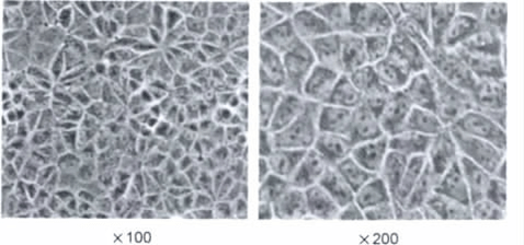 MDR1-MDCK Permeability Assay