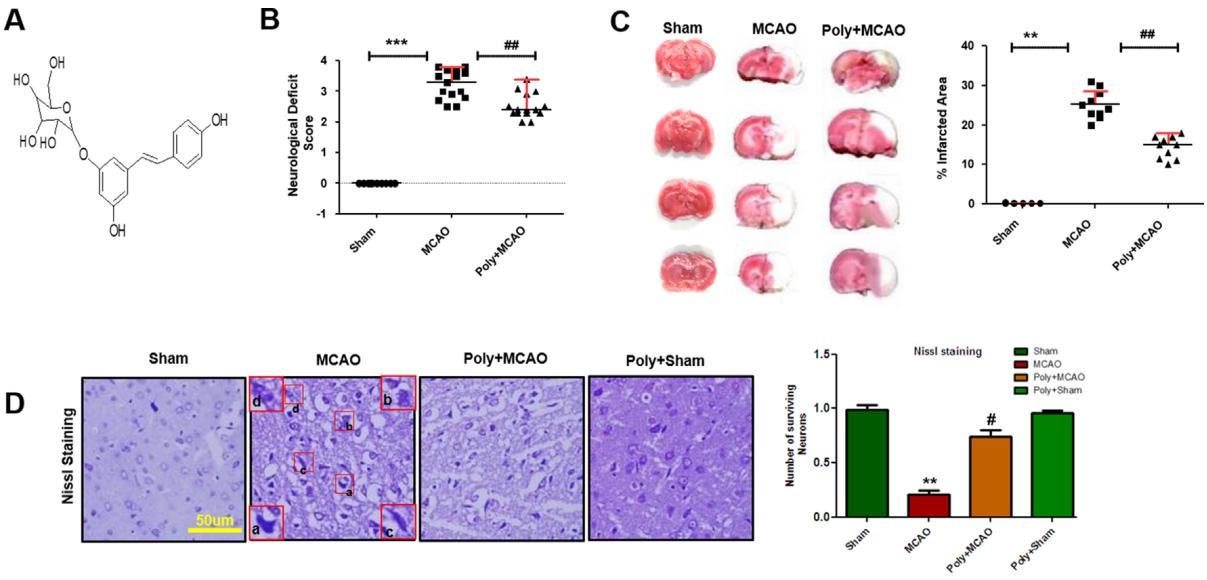 Fig. 2 Effect of polydatin on neurological scores, brain infarction and neurodegeneration.