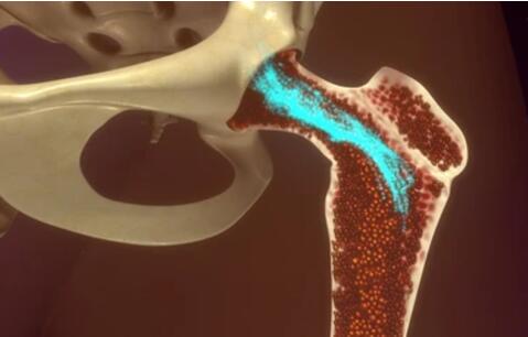 Bone Marrow Cells