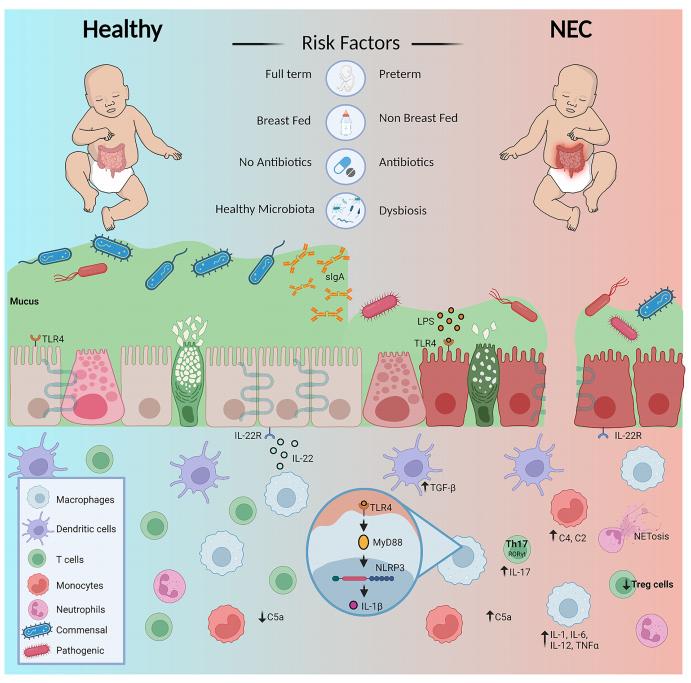 Fig. 1 Diagrammatic overview of factors predispose premature infants to NEC and dysregulation of immunity contributing to the diseased state.