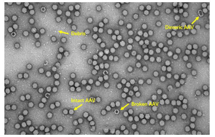 nsTEM image of AAV particles.