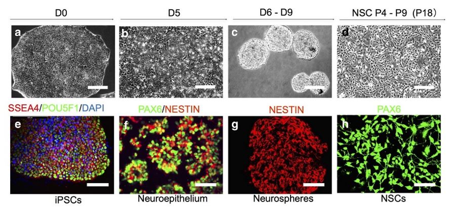 Representative phase contrast images (upper panel) and immunostaining for specific stages during neural induction from iPSCs to NSCs. 