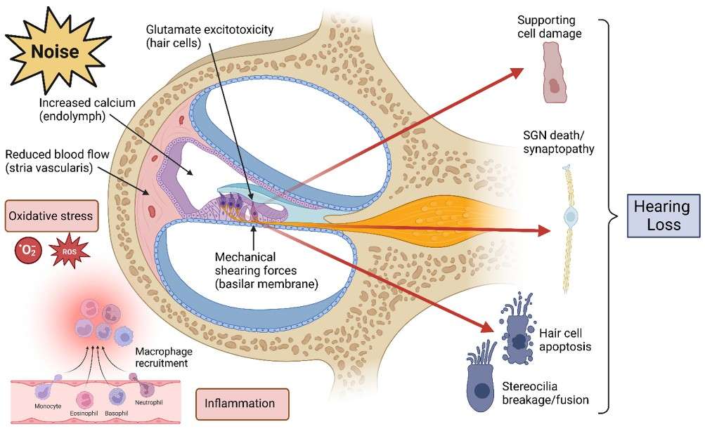 Mechanisms responsible for causing damage in Noise-Induced Hearing Loss (NIHL).
