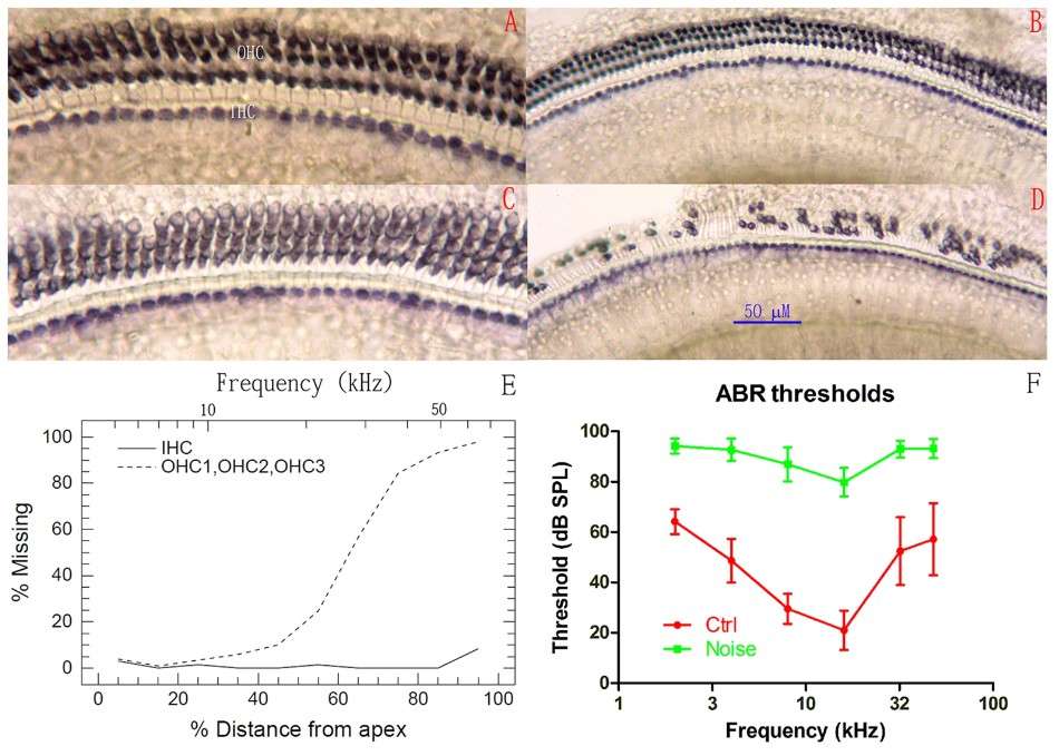 Images showing noise-induced hair cell loss and ABR threshold shifts 3 months post-exposure. Control (A, B) vs. noise-exposed (C, D) groups with significant OHC loss in (D). Cochleogram (E) and ABR thresholds (F).