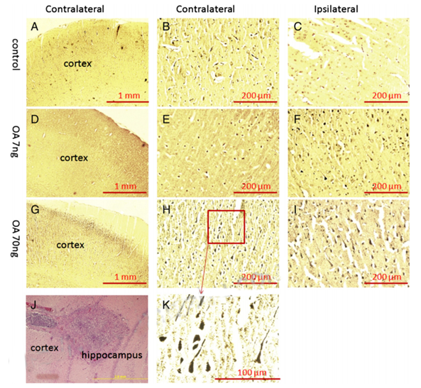 Okadaic Acid Induced Model