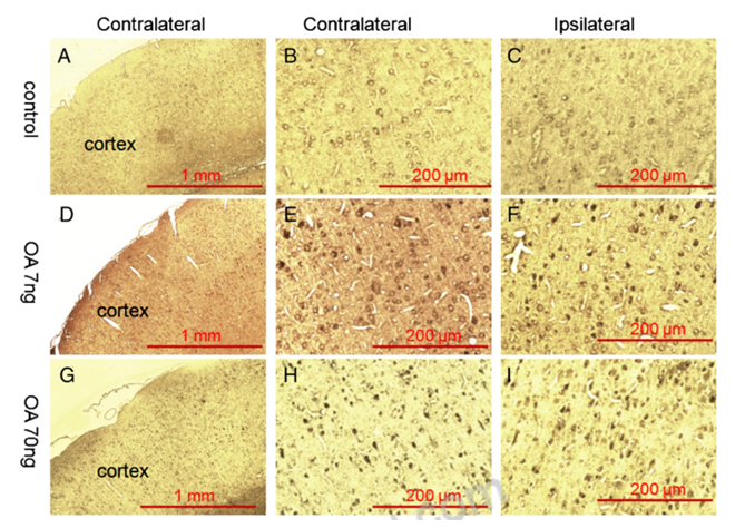 Okadaic Acid Induced Model