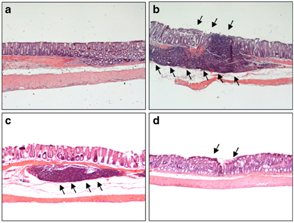 Hematoxylin and eosinstained sections of rat colon. Microscopic images refer to control rats (a) or oxazolone treated animals, either alone (b) or in the presence of PSB-0777 (0.4 mg/kg/day) (c) or dexamethasone (1 mg/kg/day) (d) 