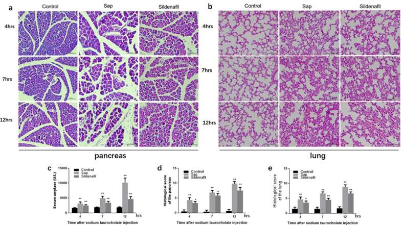 Fig. 2 Morphological changes and histopathological score of SAP-ALI.