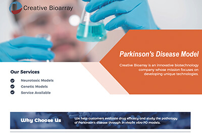 Parkinson's Disease Model