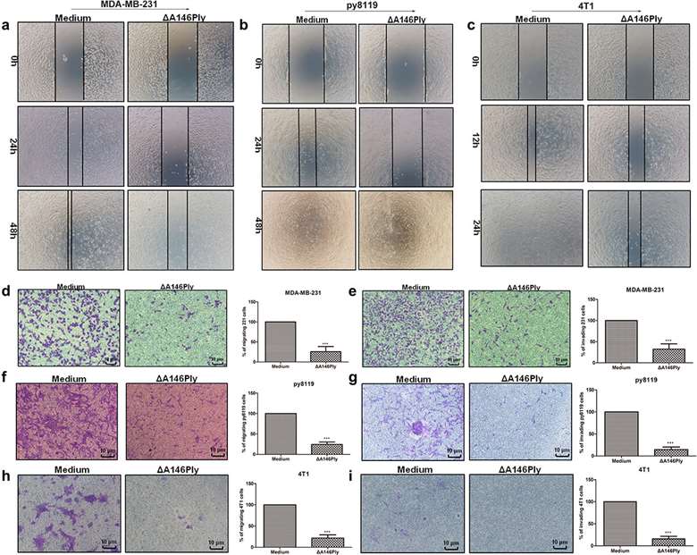 After ΔA146Ply treatment, TNBC cells migrating and invading through transwell inserts towards serum are shown.
