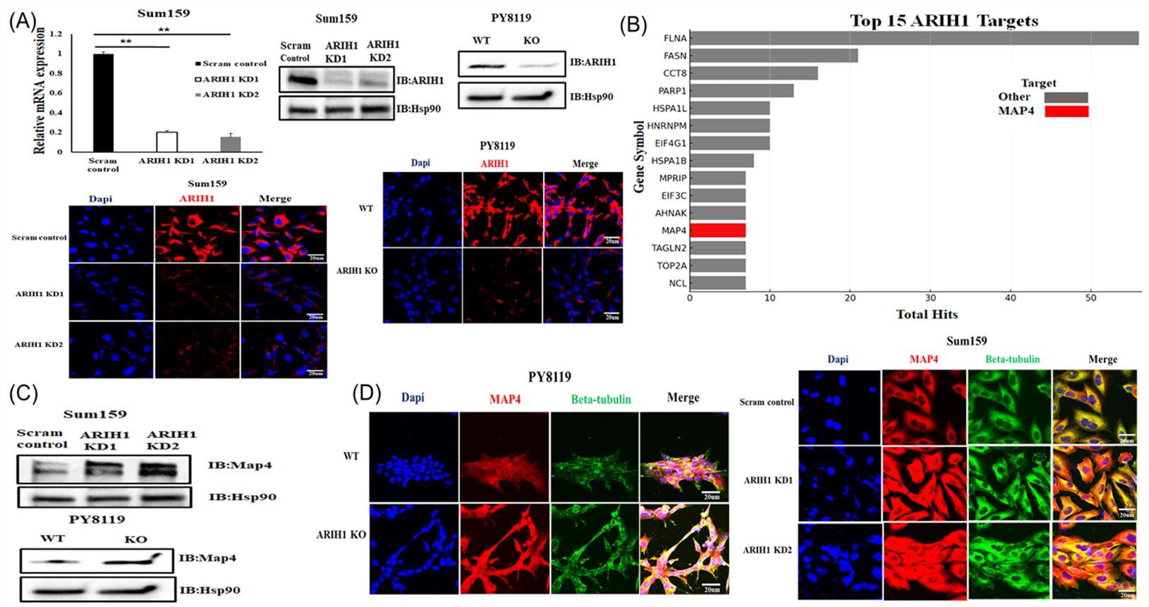 Western blot and Immunofluorescence analysis of MAP4 expression in PY8119 and Sum159 cells.