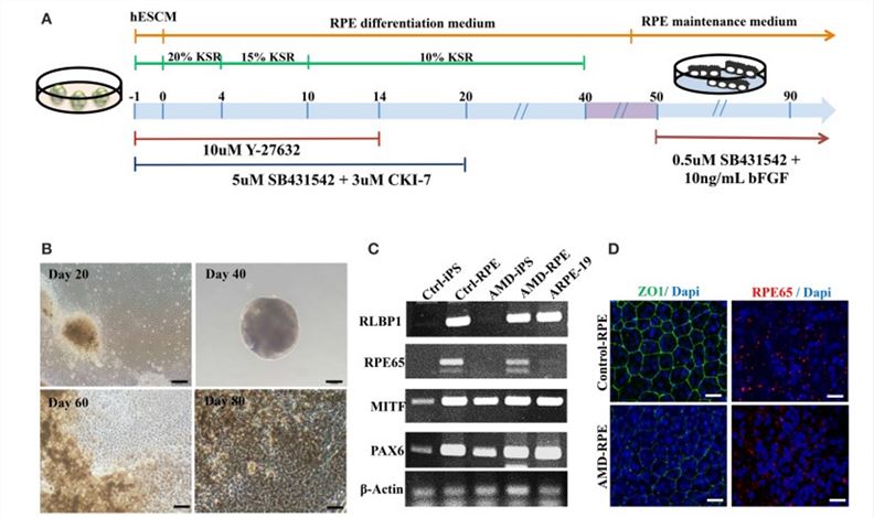 Differentiation of induced pluripotent stem cells into retinal pigment epithelial cells.
