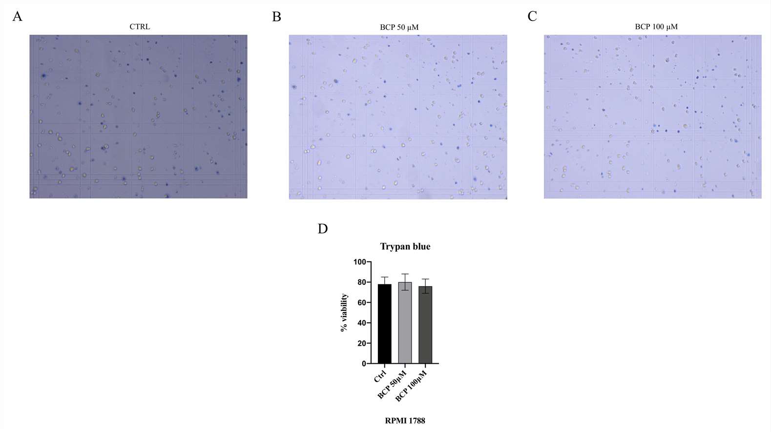 Trypan blue assay was performed to confirm the selective antiproliferative effect of BCP on the MM.