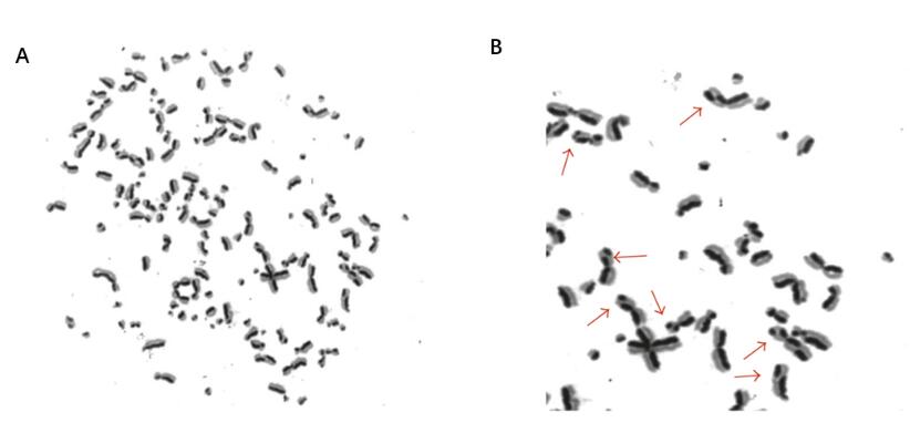 Endogenous sister chromatid exchanges in sarcoma cells.