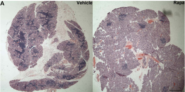 Hematoxylin-eosin staining of LG from NOD mice after Rapa eye drops reveals suppression of lymphocytic infiltration.