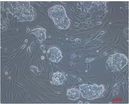 The morphology of cells derived from fibroblast about two weeks after reprogramming.