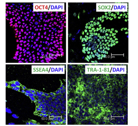 Characterization result of iPSC by immunostaining with Oct4, Sox2, SSEA4, and Tra1-81.