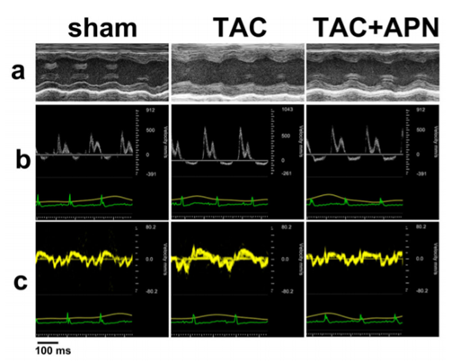Evaluation of cardiac function in three groups of mice. a M-mode echocardiography showed increased left ventricular posterior wall thickness (LVPW) in TAC mice while APNtreated mice demonstrated reduced LVPW. b Mitral inflow pattern and c mitral annular velocity of TAC group revealed progressive diastolic dysfunction while APN-treated mice showed recovery of diastolic dysfunction.
 