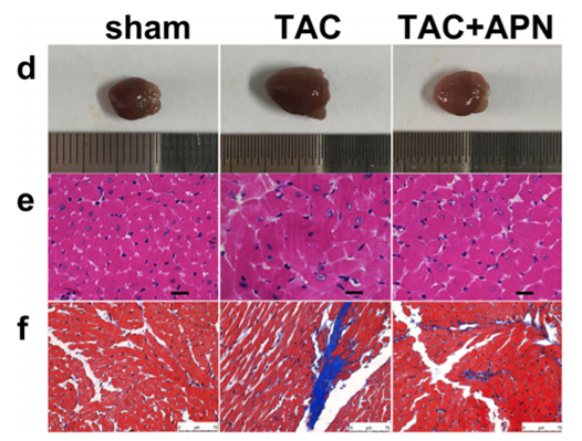 Evaluation of cardiac structure, and morphology in three groups of mice. d Representative global heart photographs. e Hematoxylin and eosin-stained LV transverse sections (original magnification × 400; sale bar, 20 μm). f Representative microscopic images of Masson’s trichrome staining (original magnification × 400; sale bar, 75 μm).
 