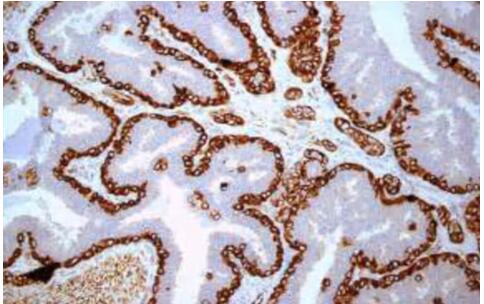 Immunohistochemistry (IHC) and Immunofluorescence (IF)