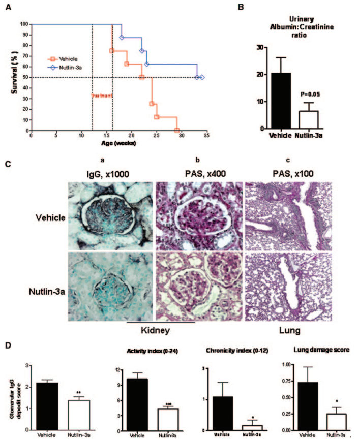 Mdm2 blockade reduces kidney as well as lung injury and mortality in experimental lupus.