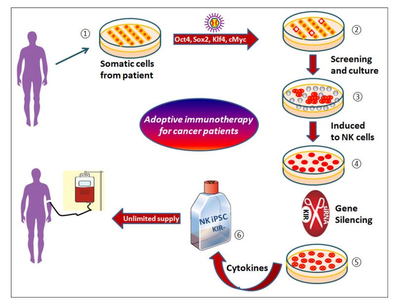 A flow chart of preparation and application of NK cells with KIR gene silencing through induced pluripotent stem cells.