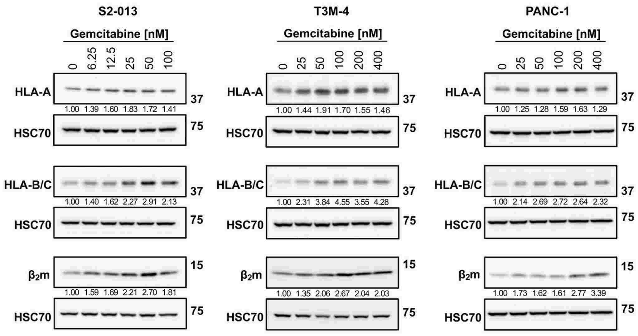 S2-013, T3M-4, and PANC-1 cells were treated with various concentrations of gemcitabine for 72 h. Western blot analysis monitored changes in total protein levels of HLA-I components.
