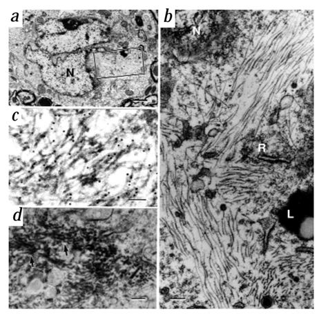 Electron microscopy of NFT in P301L (JNPL3) mice. a, A neuron with a NFT shows deep nuclear infolding (N) and filamentous cytoplasmic aggregates (boxed area; bar, 1 µm). b, Magnification of boxed area in (a) shows filaments in longitudinal and cross sections. L, lipofuscin granule; N, nucleus; R, polyribosomes. Bar, 0.2 µm. c, Immunogold labelling (CP13) of neuronal filaments (bar, 0.1 µM). d, Immunolabelling of filaments (CP13) with arrows indicating heavy peroxidase reaction product association (bar, 0.2 µm). 