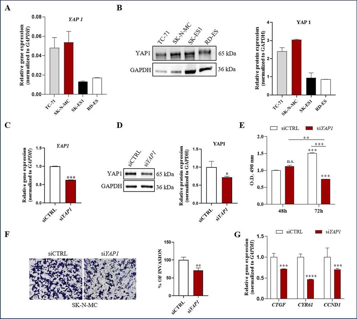 YAP1 mRNA and protein level were analyzed in different EwS cell lines and targeting YAP1 expression could be exploited to limit EwS invasiveness.