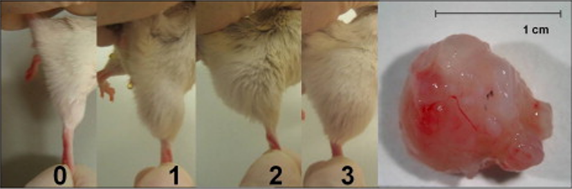 A simple grading scale for monitoring teratoma development.