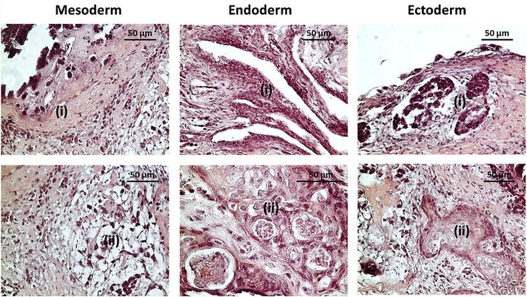 A representative microscopic image of H&E-stained teratoma sections showing iPSC-derived tissues of all three germ layers.