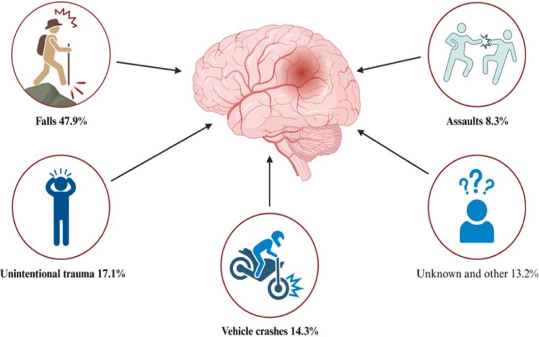 Fig. 1 Common causes of TBI