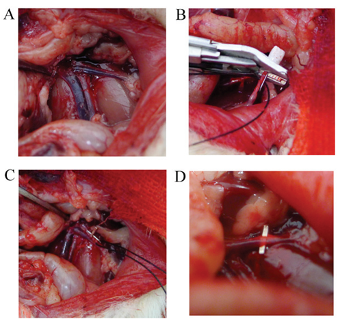  A renovascular hypertensive model was established using the 2K1C method. (A) View through a flank abdominal incision where the left renal hilum was revealed. (B) View of the renal artery and vein that were carefully isolated by blunt dissection. (C) A titanium vascular clip is shown that was successfully placed on the left renal artery, with the aid of an insulin needle tip whose outer diameter was 0.23 mm. (D) Image showing that the insulin needle tip was carefully removed.