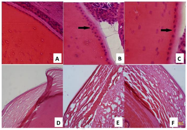 Hematoxylin-eosin staining of rat lens paraffin sections: (A) organized monolayer of cuboidal lens epithelial cells in the C group (×400); (B) multiple layers of lens epithelial cells can be seen in the DM group (×400); (C) lens epithelial cells are still in a monolayer in the AL group with slight disorganization (×400); (D) lens section from the C group (×200); (E) DM group (×200); (F) DM+AL group (×200).