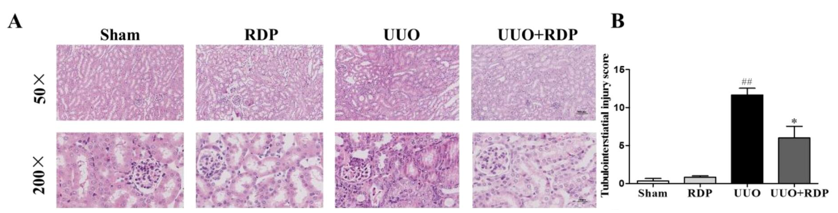 (A) Representative H&E staining of kidney sections under 50× and 200× magnification. (B) Tubulointerstitial injury score of the four groups.