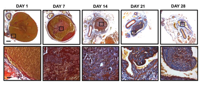 Representative micrographs of trans-verse thrombus sections stained with Martius scarlet blue (MSB) at days 1, 7, 14, 21, and 28 post induction. MSB detects collagen (blue), fibrin (red), and erythrocytes (yellow); scale bars, 200 µm (low power) and 25 µm (high power).