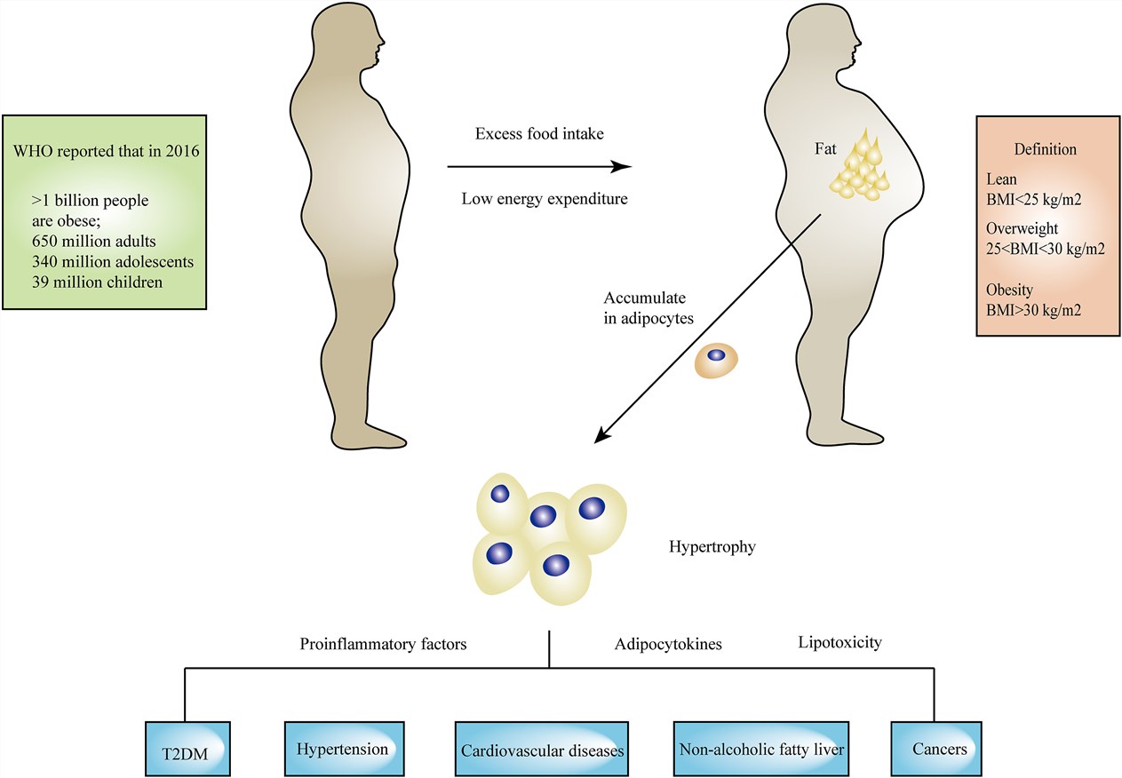 Statistics about obesity epidemic, criterion of obesity definition and obesity-related diseases.