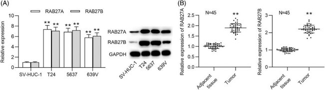 RAB27A/B expression is upregulated in BCa tissues and cells.