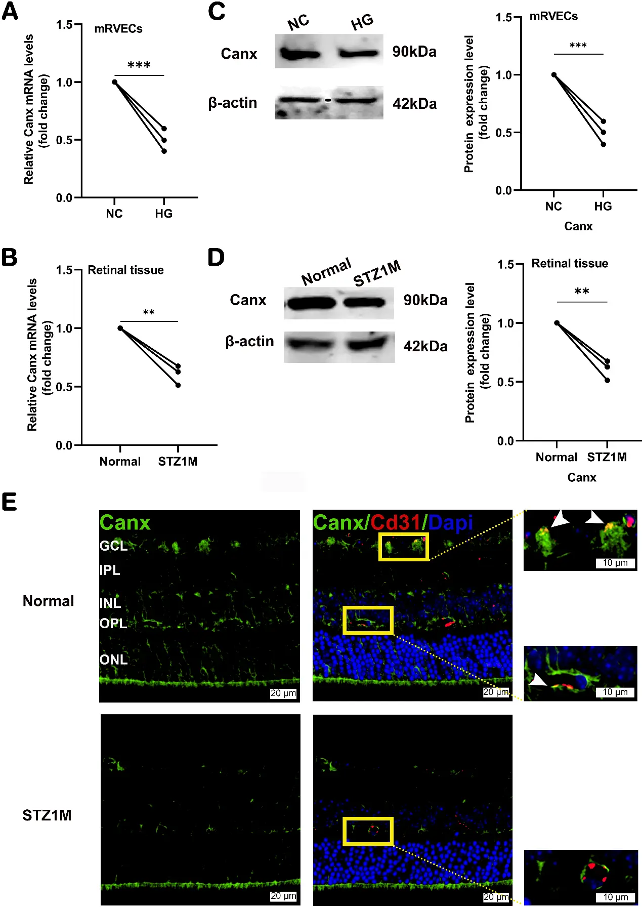 Canx Expression Is Decreased in HG-Induced mRMVECs and STZ-Induced Diabetic Mouse Retina.