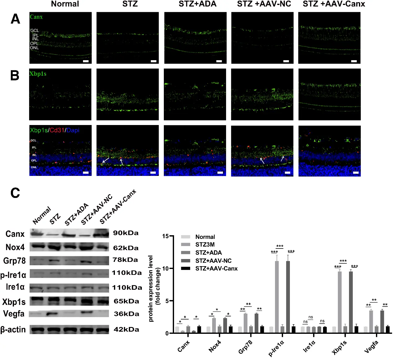 Canx Inhibits the Nox4/Ire1α/Xbp1s/Vegfa Signaling Pathway in STZ-Induced Diabetic Mice.