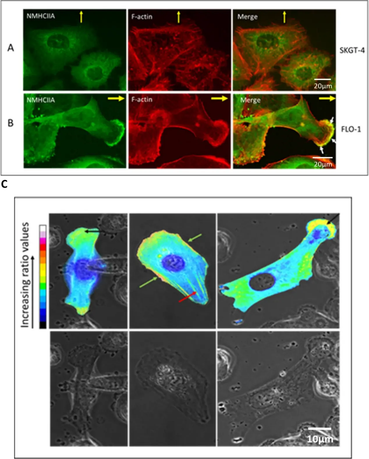 NMHCIIA co-localizes with F-actin at the lamellipodial leading edge of migrating FLO-1 cells but does not co-localize with F-actin at the leading edge of migrating SKGT-4 cells.