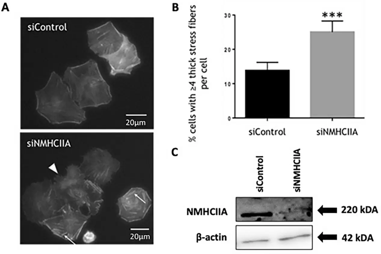 NMHCIIA depletion alters FLO-1 cell morphology and F-actin organization.