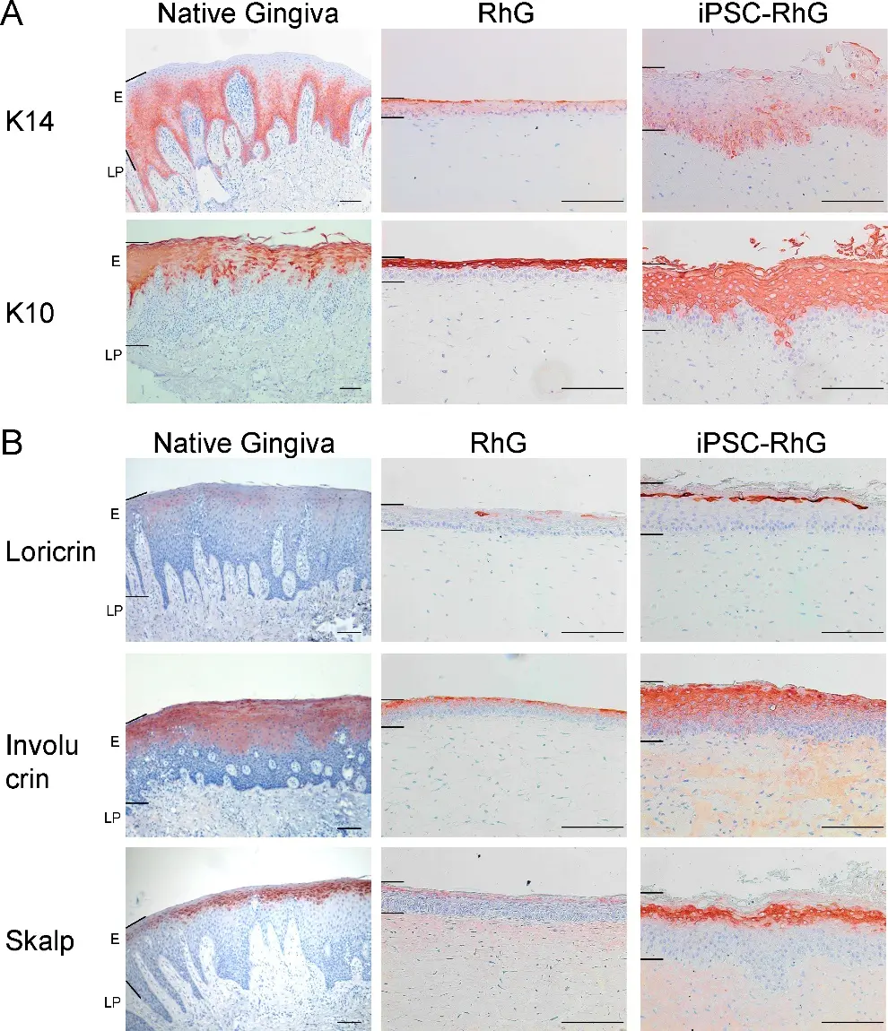 Incorporation of iPSCs into Reconstructed Human Gingiva results in in vivo like differentiation of gingival epithelium.